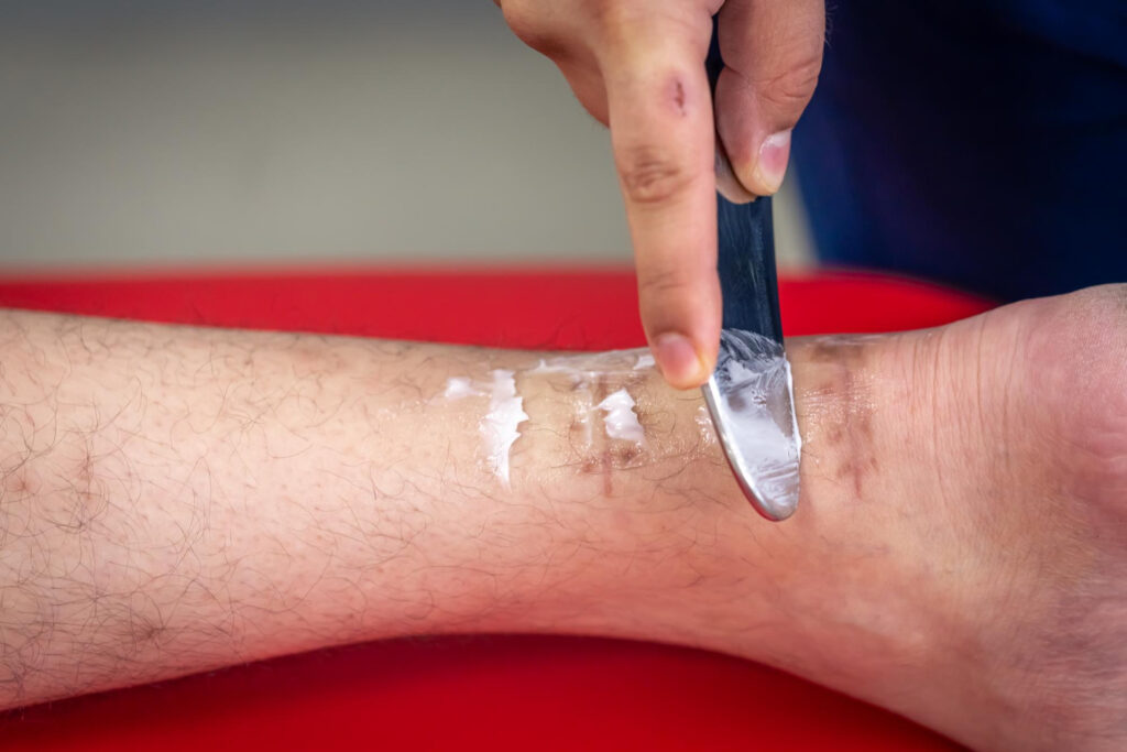 IASTM Therapy in Palatine